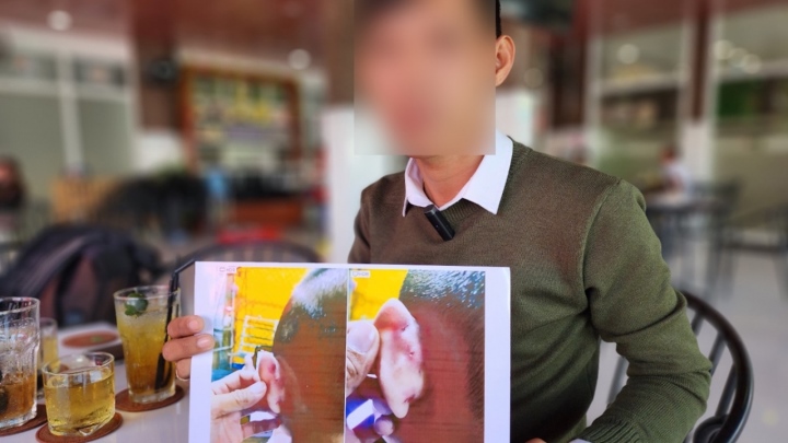 Khởi tố cô giáo mầm non đánh trẻ gây thương tích ở Kiên Giang